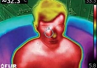 Cámaras termográficas en el sector salud